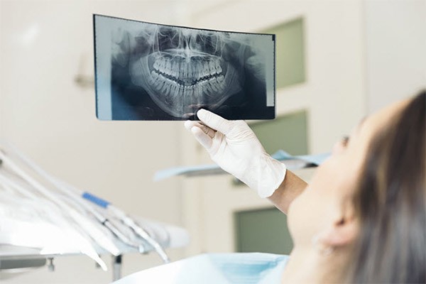 استخوان فک و ایمپلنت دندان