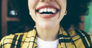بستن فاصله بین دندان ها با باندینگ دندان