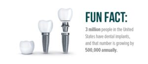 حقایقی در مورد ایمپلنت دندان