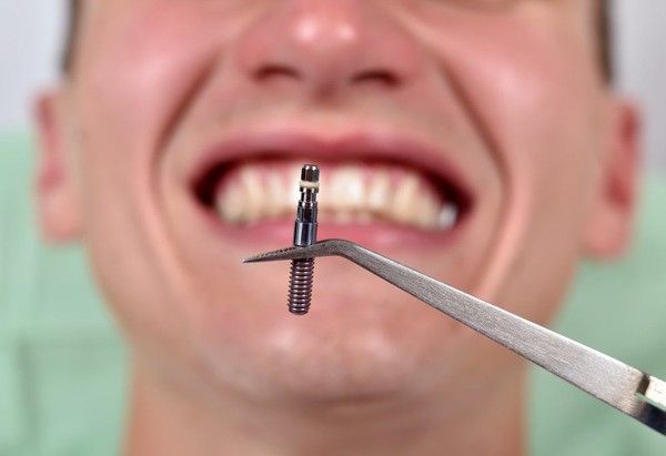 چرا جای ایمپلنت دندان درد می گیرد
