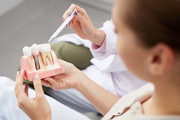 درد بعد از کشیدن دندان یا ایمپلنت دندان بیشتره