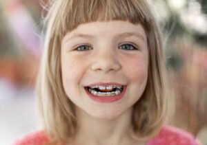 تشخیص مسائل اولیه برای ارتودنسی دندان کودکان