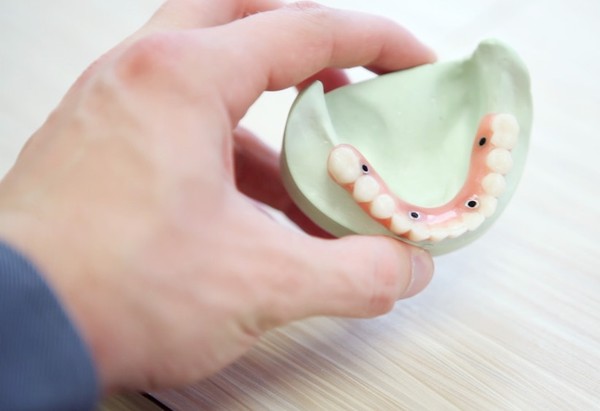 گزینه های پیشنهادی برای جایگزینی دندان تان؟!