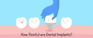 آیا انجام ایمپلنت دندان دردناک است؟