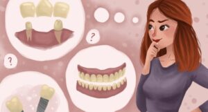 چه مدت طول می کشد تا بریج دندان در جای خود ثابت شود؟